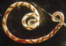 Rat lungworm